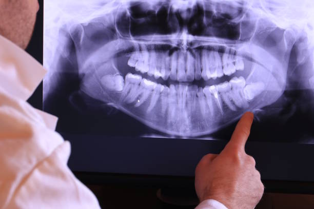 Best Tooth Infection Emergency Dentist  in Newfield, NJ